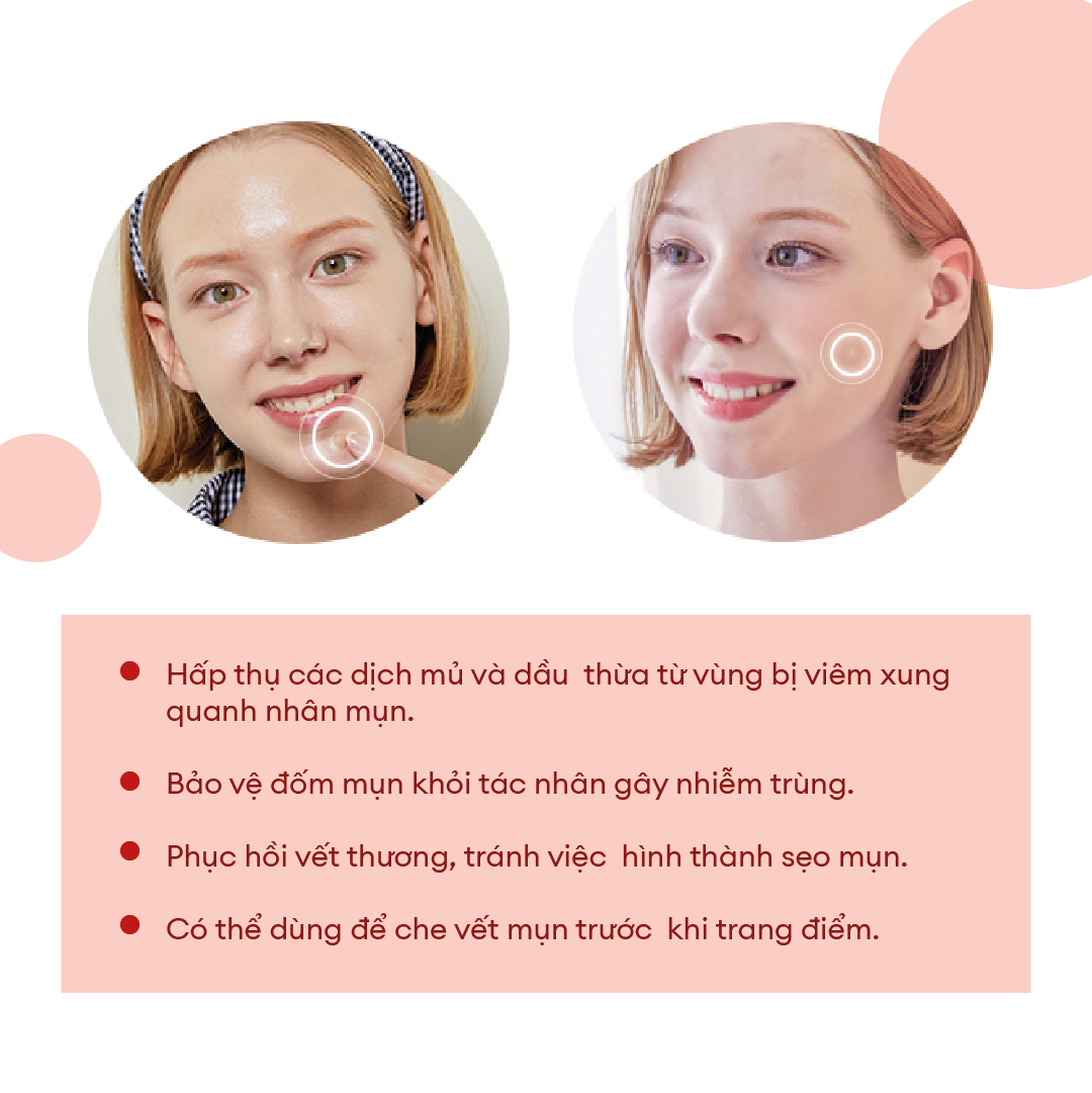 Dán Mụn COSRX Acne Pimple Master Patch 24 miếng