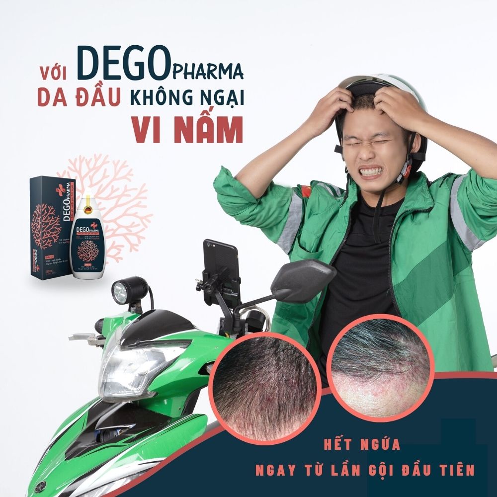 Combo dầu gội &amp; kem bôi dứt điểm nấm da, vảy nến, á sừng Dego Pharma