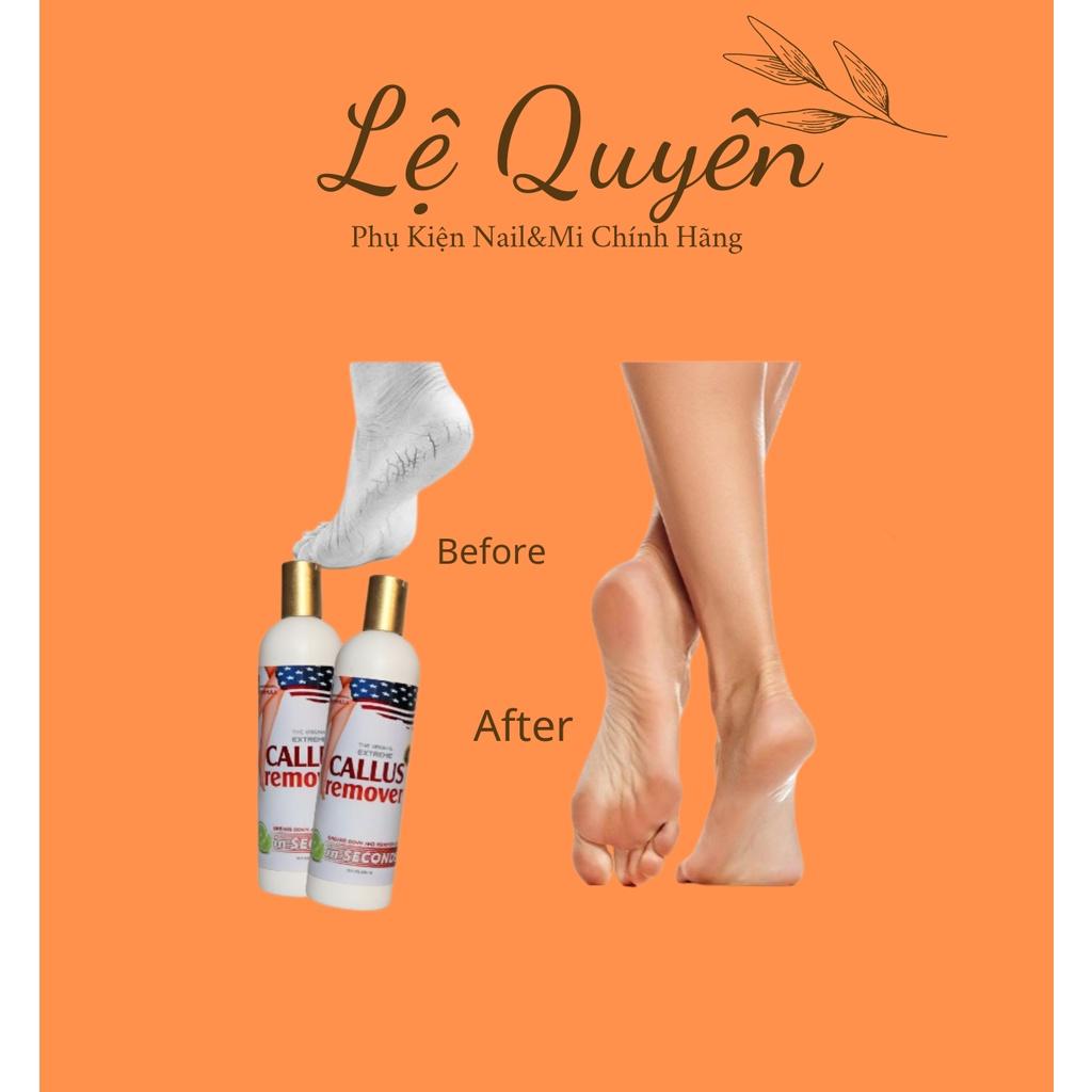 Gel Ủ Chà Gót Chân Cho Thợ Chuyên Nghiệp DND CALLUS REMOVER