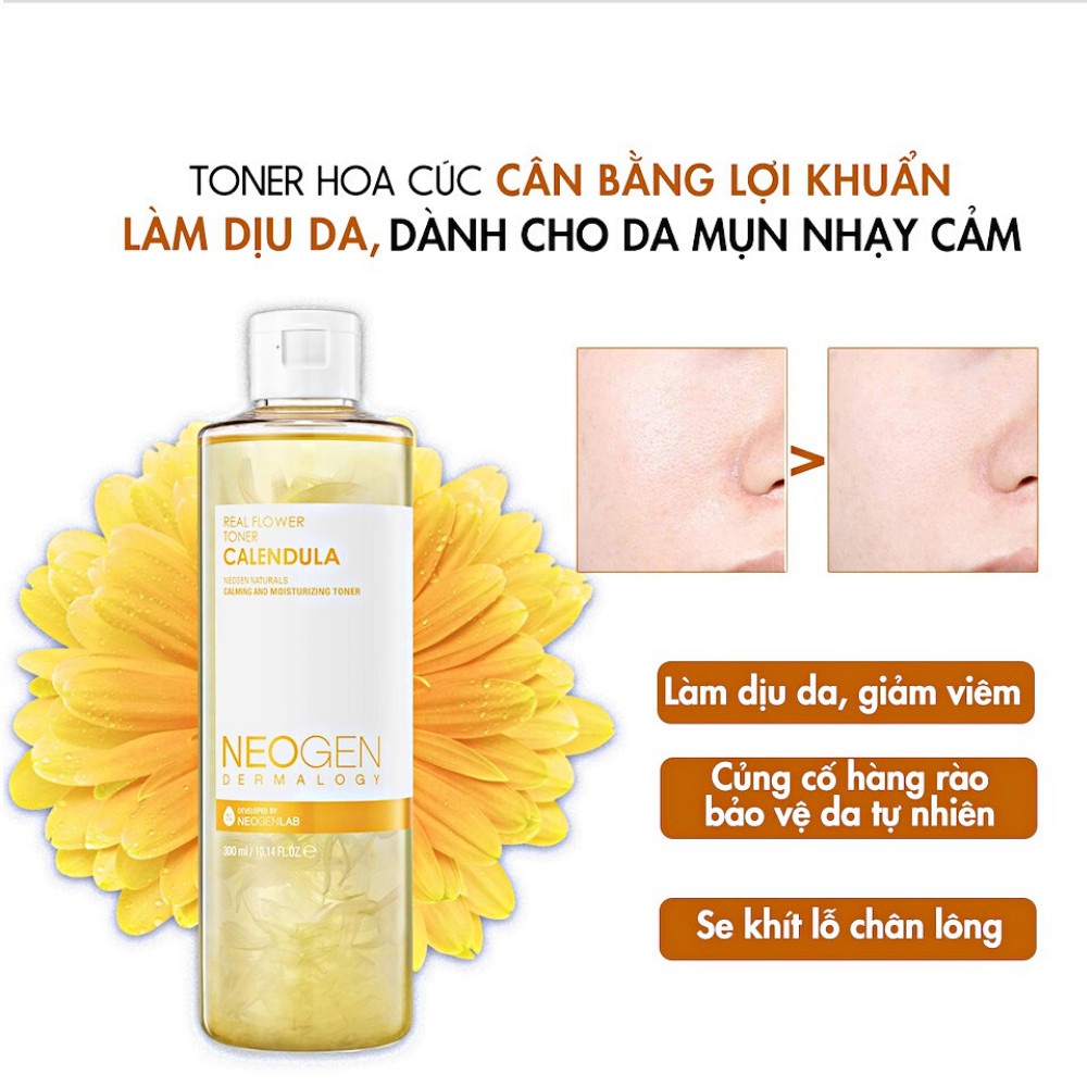 Nước Hoa Hồng Chiết Xuất Hoa Cúc Cấp Ẩm Dịu Da Cho Da Mụn Neogen Dermalogy Real Flower Calendula Toner 300ml