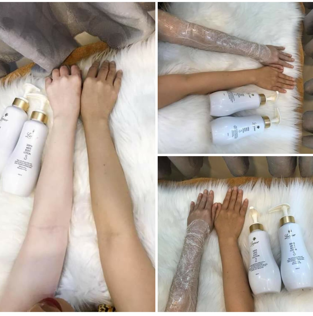 Kem dưỡng trắng toàn thân Hàn Quốc, cung cấp độ ẩm, ức chế melanin làm trắng sáng da, Larian Derma White Body Lotion 