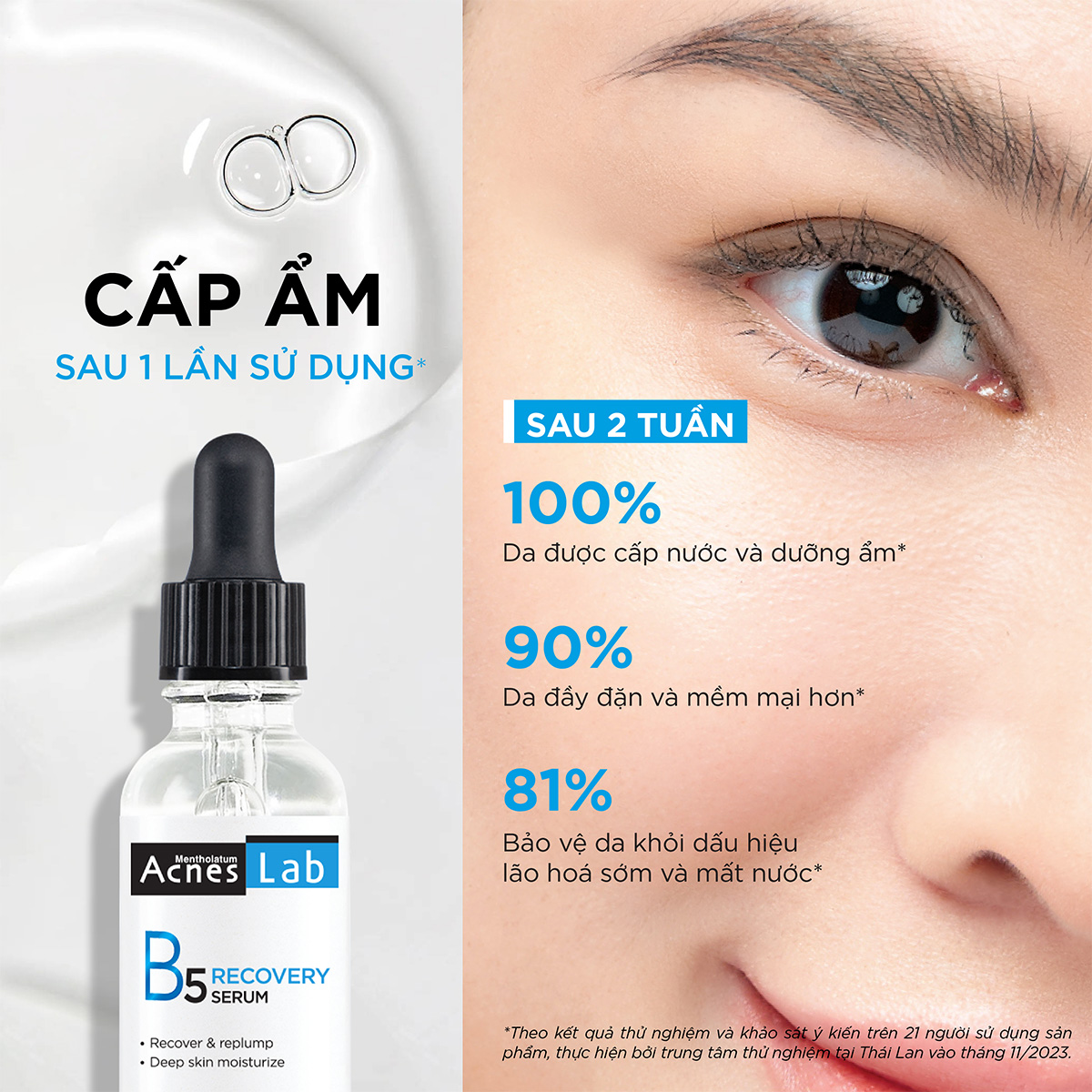 Serum dưỡng ẩm chuyên sâu, làm dịu da Acnes Lab B5 Recovery Serum 25ml