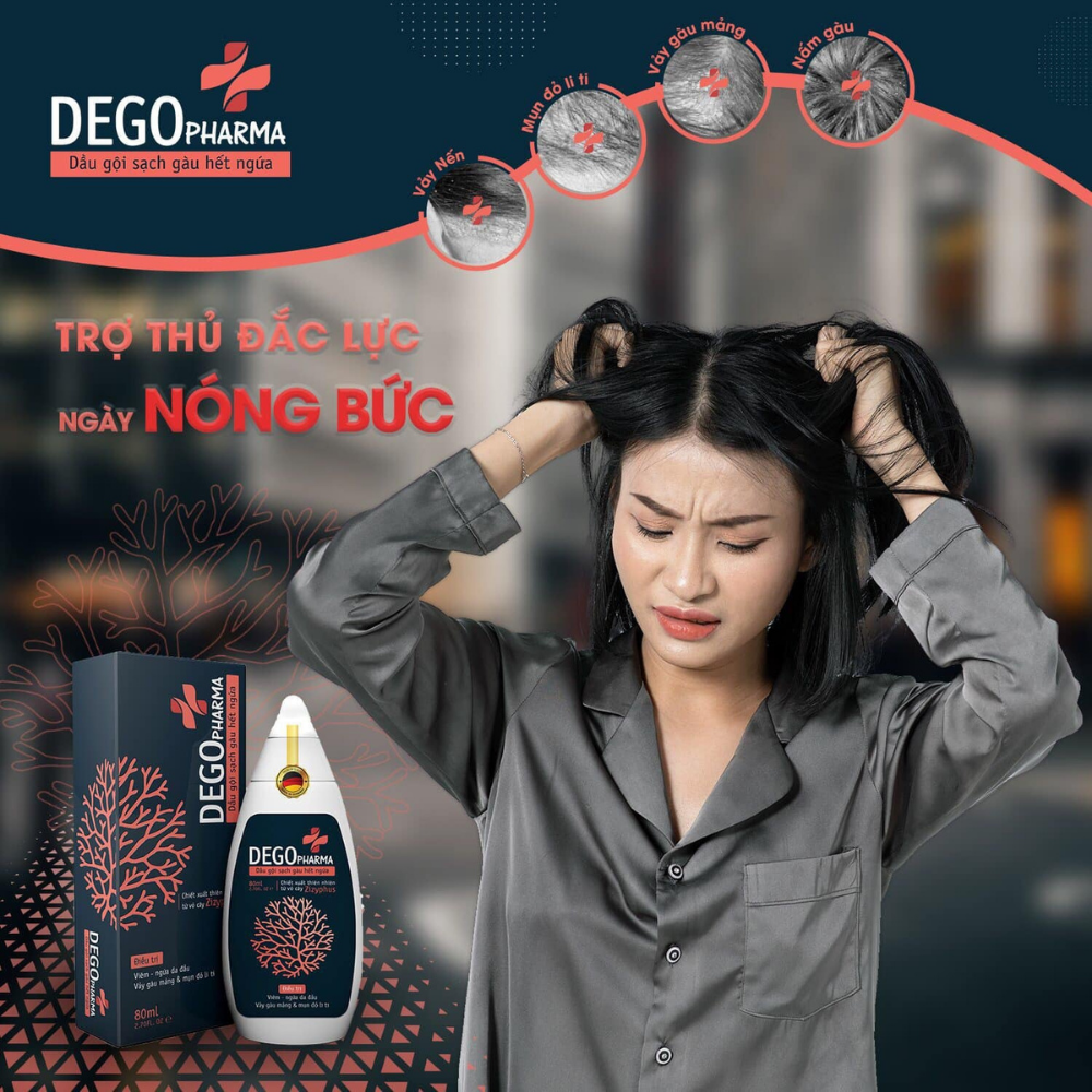 Dego Pharma - Dầu gội sạch vảy gàu mảng trắng, hết ngứa chiết xuất thiên nhiên từ vỏ cây Zizyphus, sản xuất theo tiêu chuẩn và dưới sự giám sát của công ty dược phẩm Châu Âu