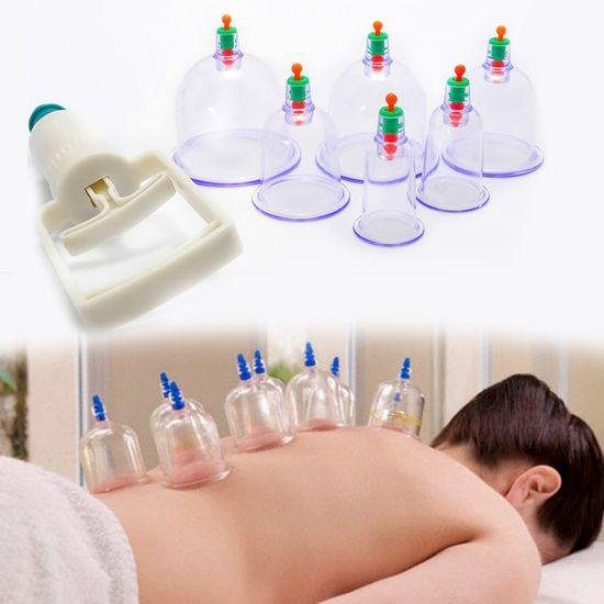Giác hơi, Bộ giác hơi, Bộ giác hơi không dùng lửa loại tốt