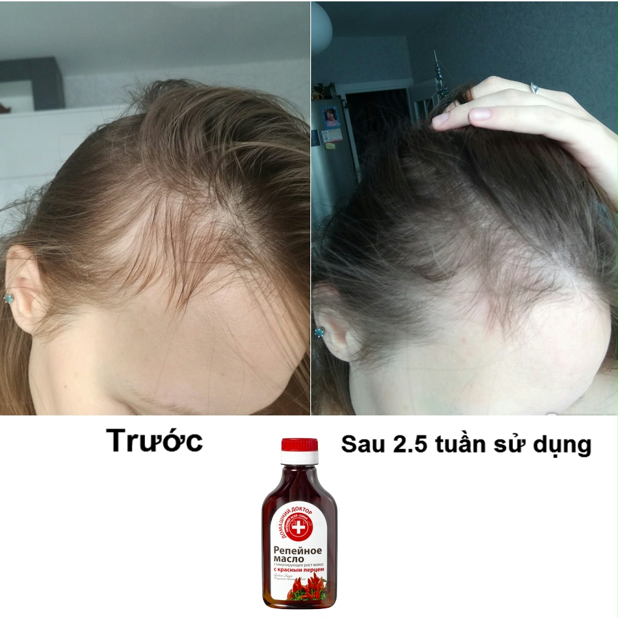 Dầu ngưu bàng kích thích mọc tóc Domashnij Doctor 100 ml