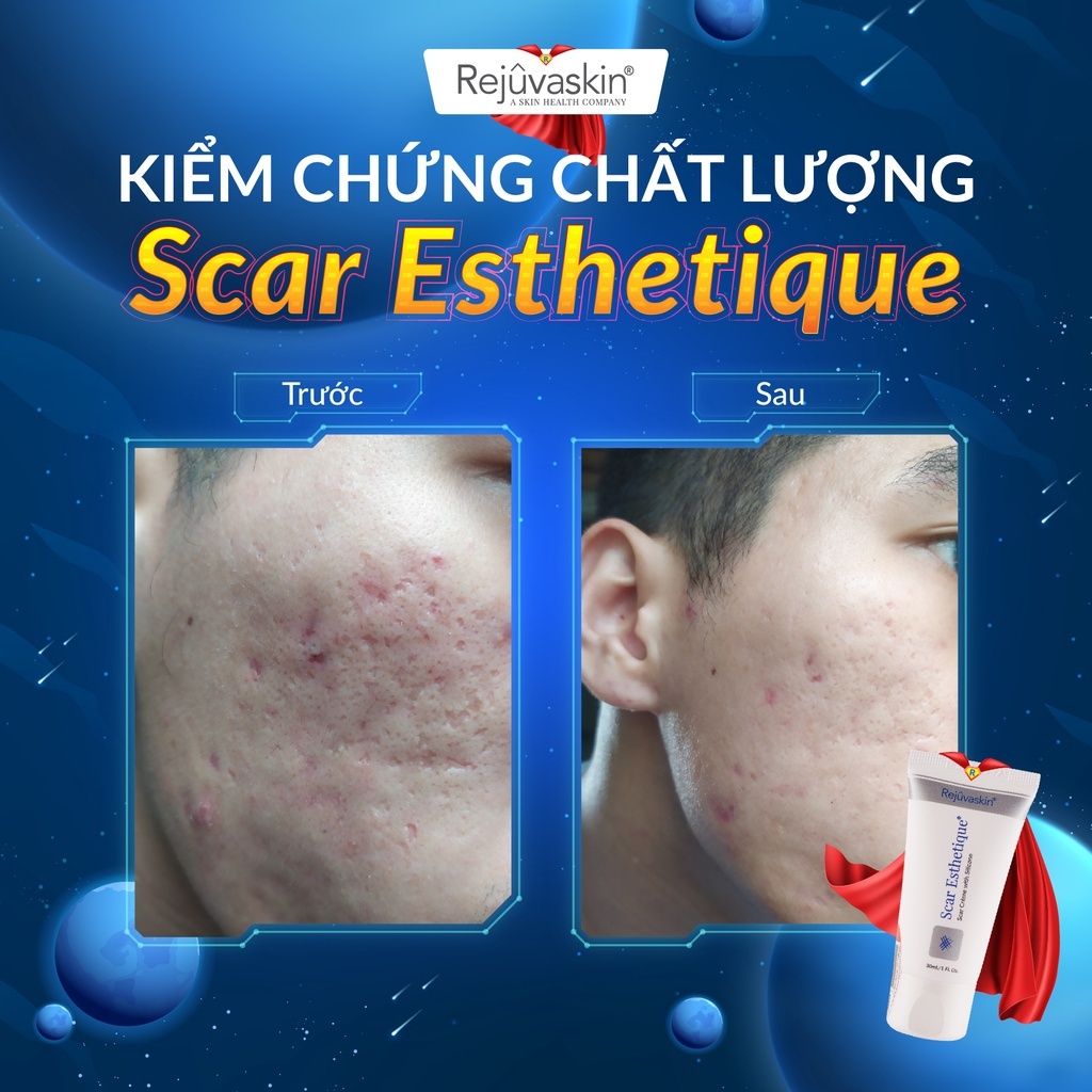 Kem Làm Mờ Sẹo Thâm, Sẹo Rỗ, Sẹo Lõm Scar Esthetique của Rejuvaskin - thương hiệu hỗ trợ trị sẹo Hoa Kỳ