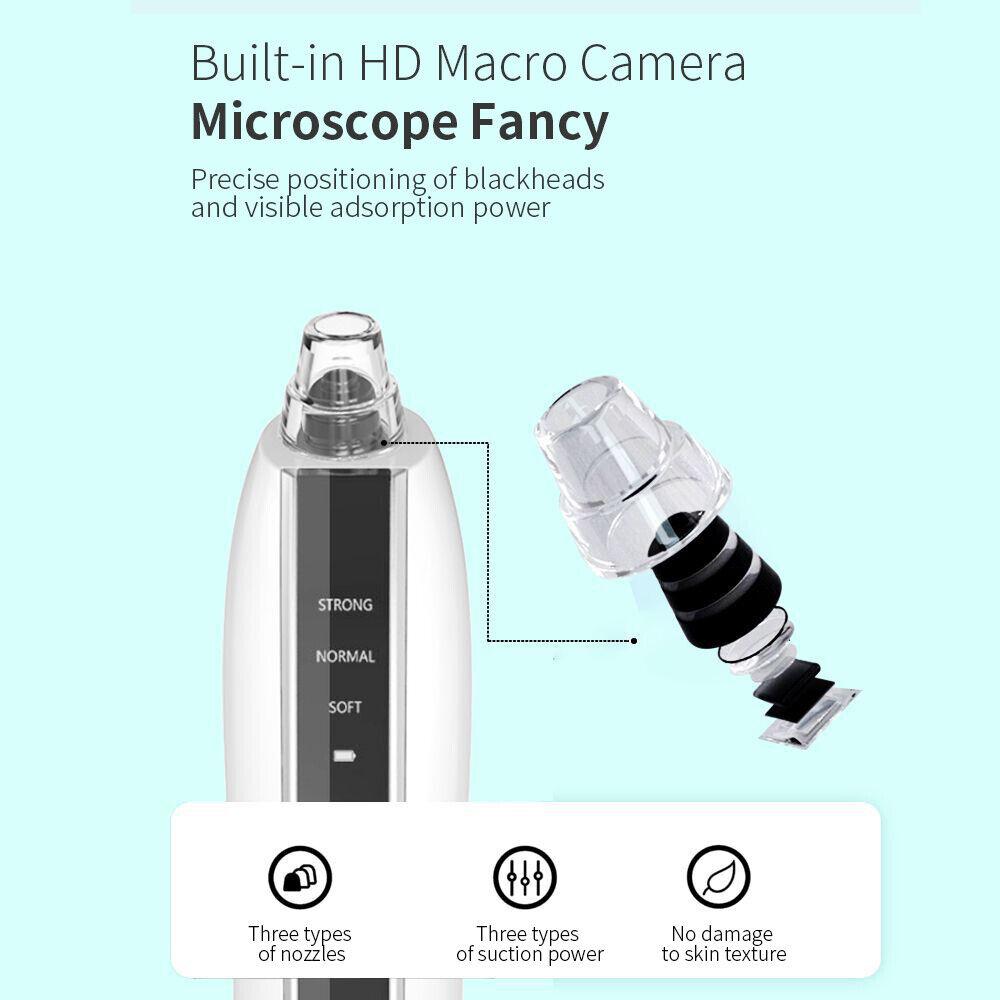 Dụng Cụ Hút Mụn Cám Mụn Đầu Đen VisualTech WiFi HD Có Camera hiển thị - Riki Shop