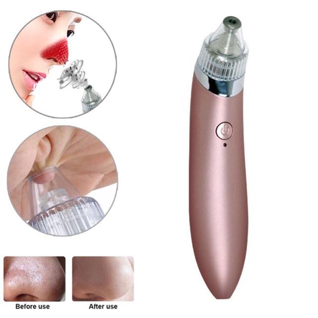 Máy hút mụn có pin sạc