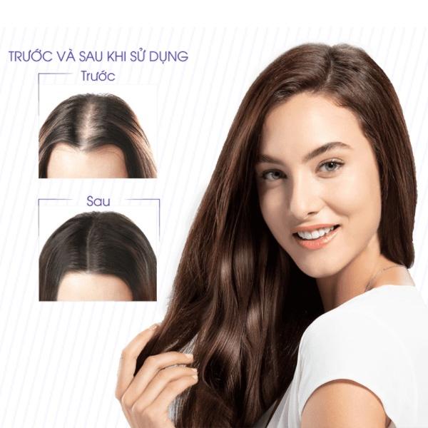 Viên uống QIK HAIR (cho Nữ) hỗ trợ giảm rụng, mọc tóc chắc khỏe (30 viên)