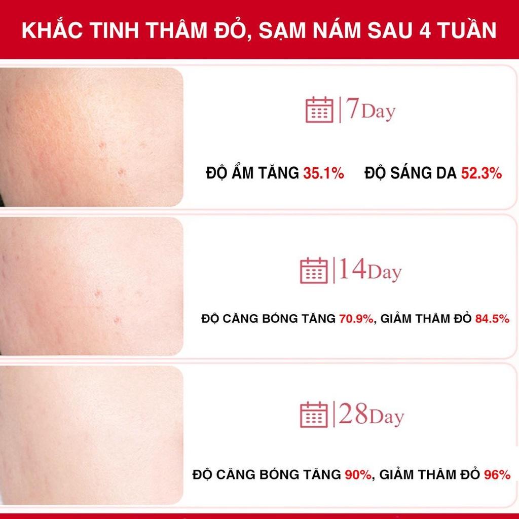 Combo 2 Angel's Liquid Tranexamic Mela Mờ Sạm Thâm Nám Chuyên Sâu  ( Serum Tranexamic 30ml + Kem Nám Tranexamic 50ml )