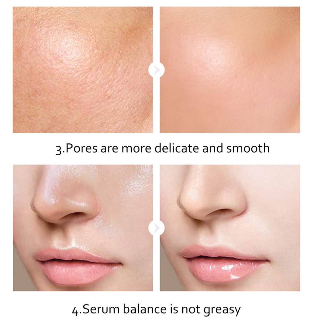 BSKM Soothing Serum Dưỡng Trắng Da, Mờ Thâm, Căng Bóng Và Chống Lão Hóa Da 28ml