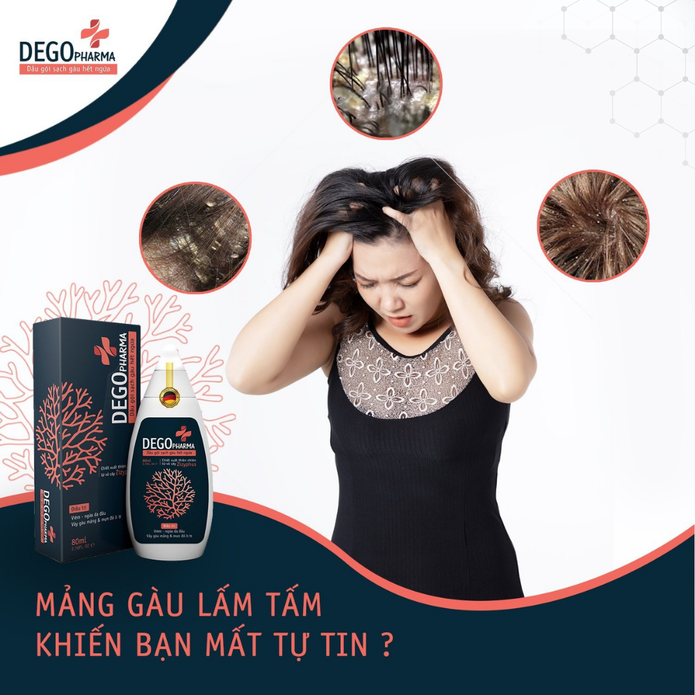 Dego Pharma - Dầu gội sạch vảy gàu mảng trắng, hết ngứa chiết xuất thiên nhiên từ vỏ cây Zizyphus, sản xuất theo tiêu chuẩn và dưới sự giám sát của công ty dược phẩm Châu Âu