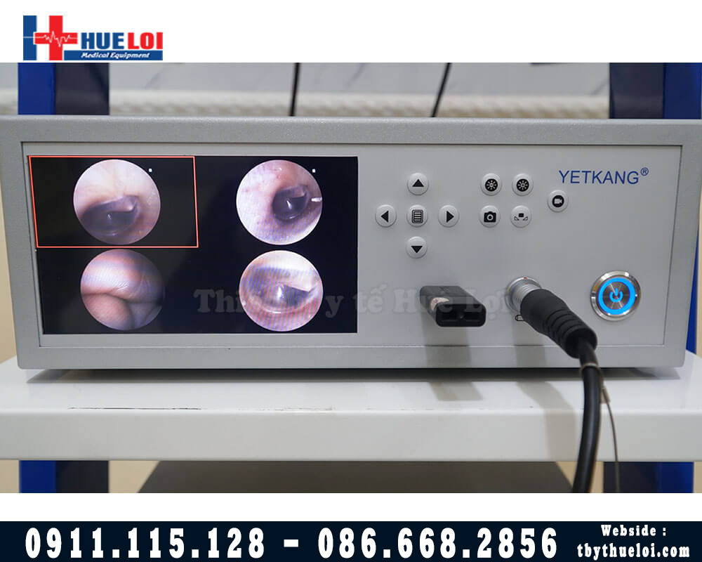 Máy Nội Soi Tai Mũi Họng FULL HD - FHD 180 - Hình Ảnh Sắc Nét Có Kèm Màn Hình Mini 7ich,Kèm 2 optic tùy chọn