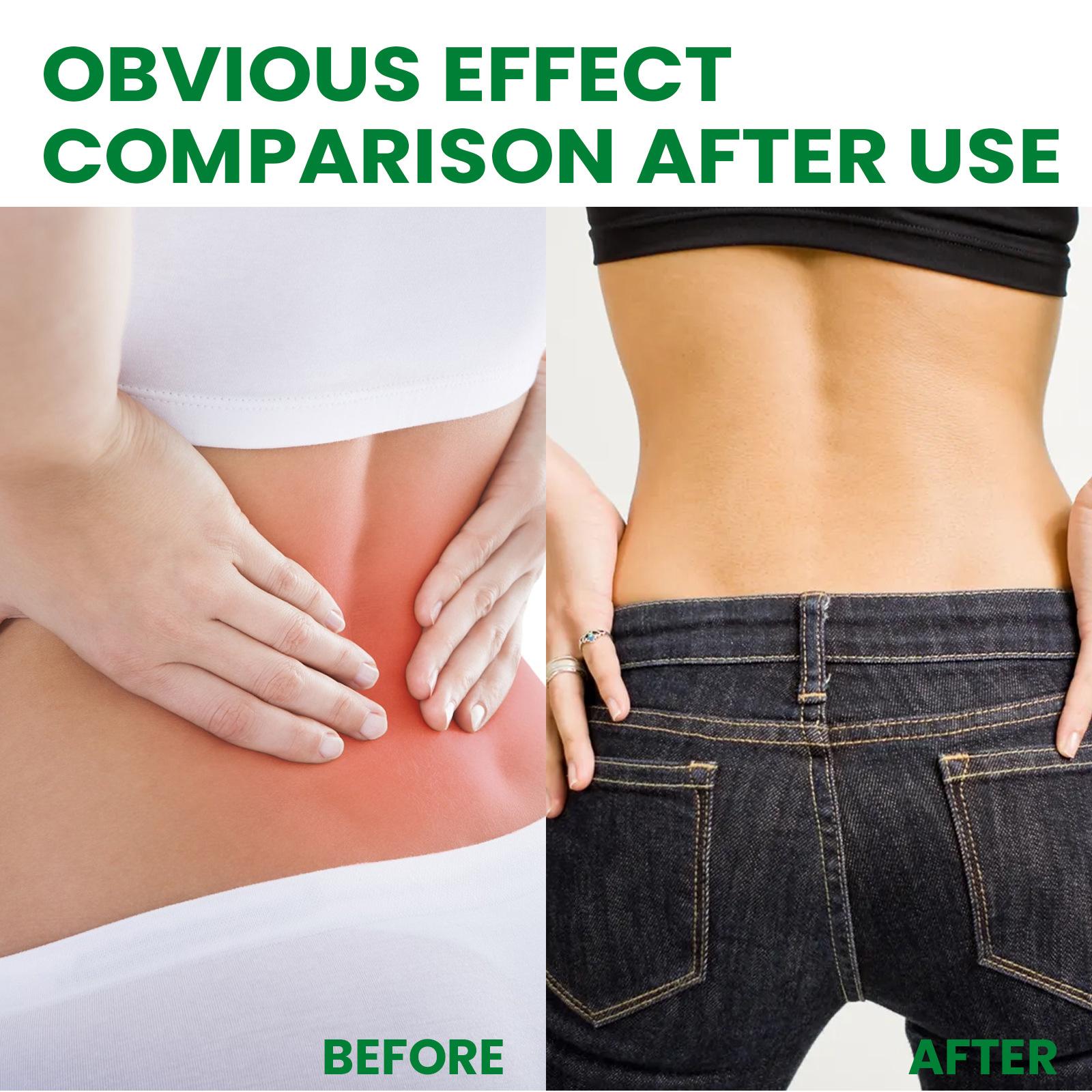 South Moon 10Pcs Lymphatic Drainage Foot Soak Mild Herbal Stimulate Detoxfication Foot Bath Bags