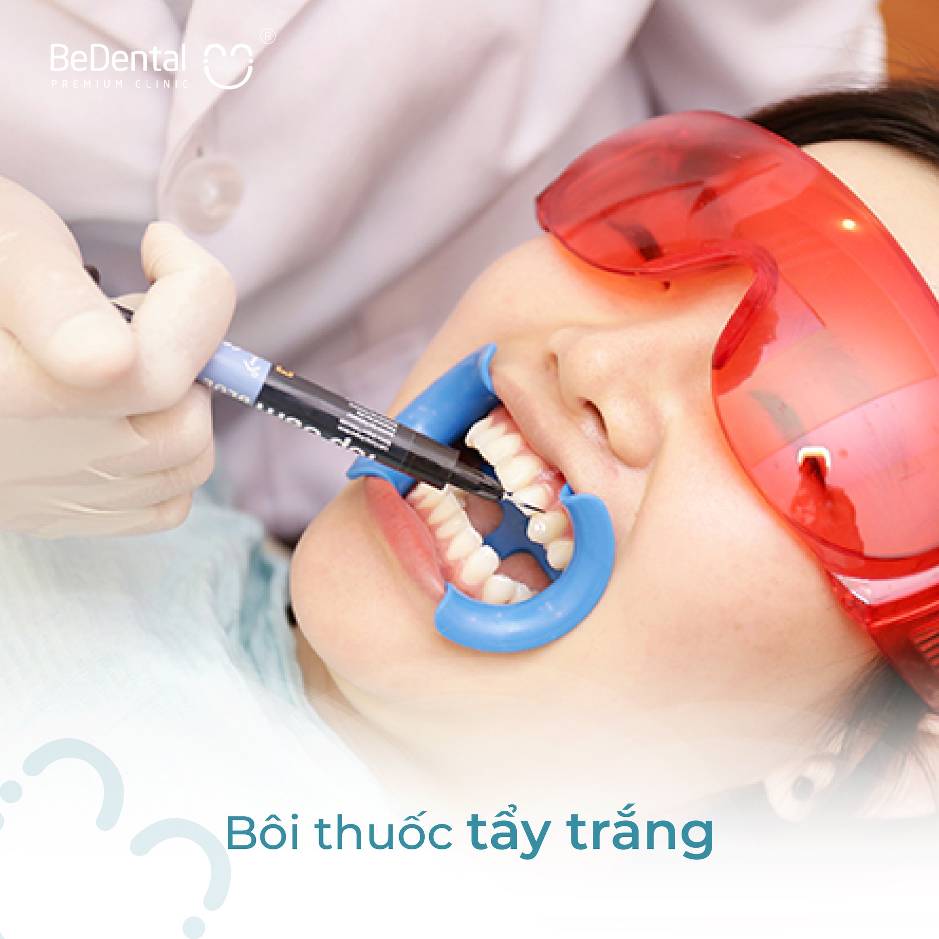 Tẩy trắng răng phương pháp Laser Whitening 5P - Nha khoa BeDental (5 chi nhánh)