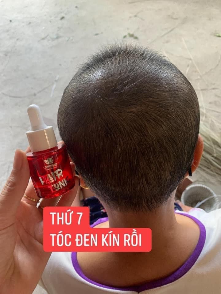 Hair Tonic - Dưỡng Tóc, Giúp Tóc Mềm Mượt, Ngăn Ngừa Rụng Tóc