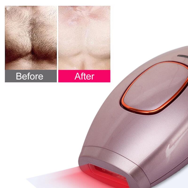 Máy cạo lông bằng laser IPL 300000 Cạo lông và triệt lông Máy cạo lông vĩnh viễn cho phụ nữ