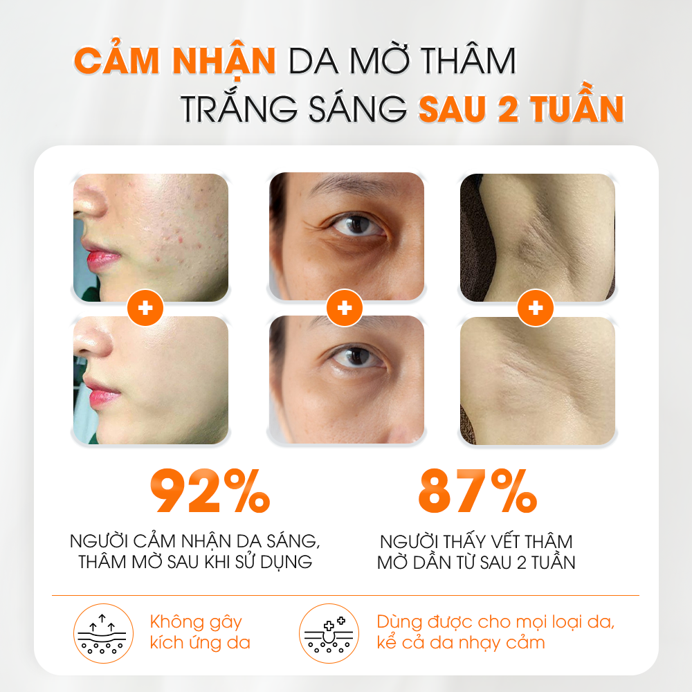 Serum Nghệ Đỏ Nano ABERA - Đánh bật mọi loại thâm