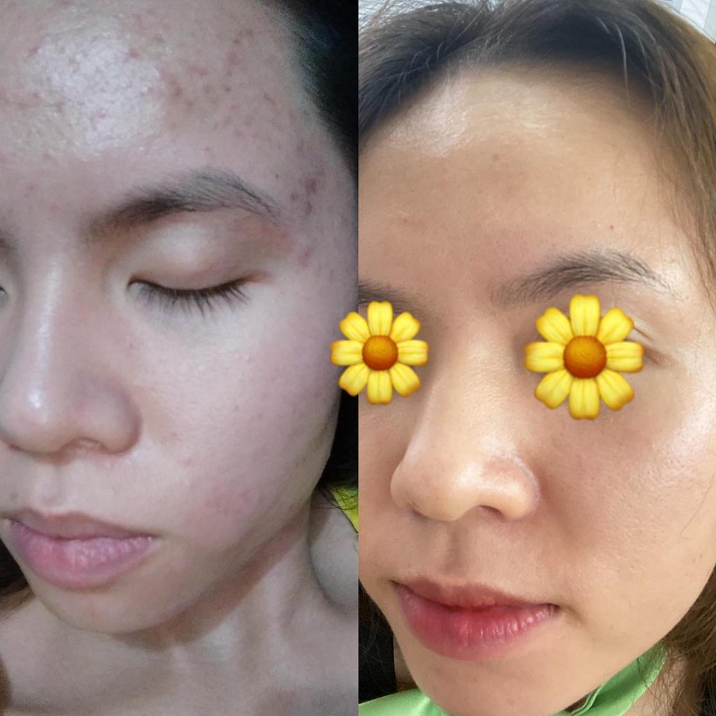 Sample Sữa rửa mặt da mụn nhạy cảm từ trà xanh tảo biển The Beauty of Jones