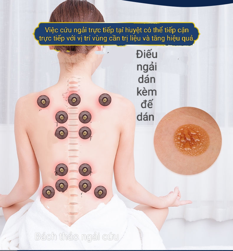 Hộp 50 Nhang ngải cứu dán 7 mm và 10 mm, ngải đoạn có đế dán cố định