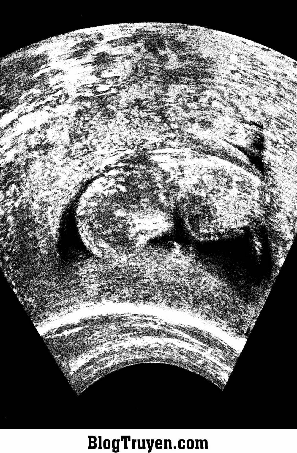 homunculus chapter 146 13