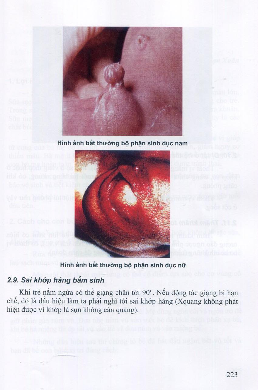 Sách - Thủ thuật sản phụ khoa 2023