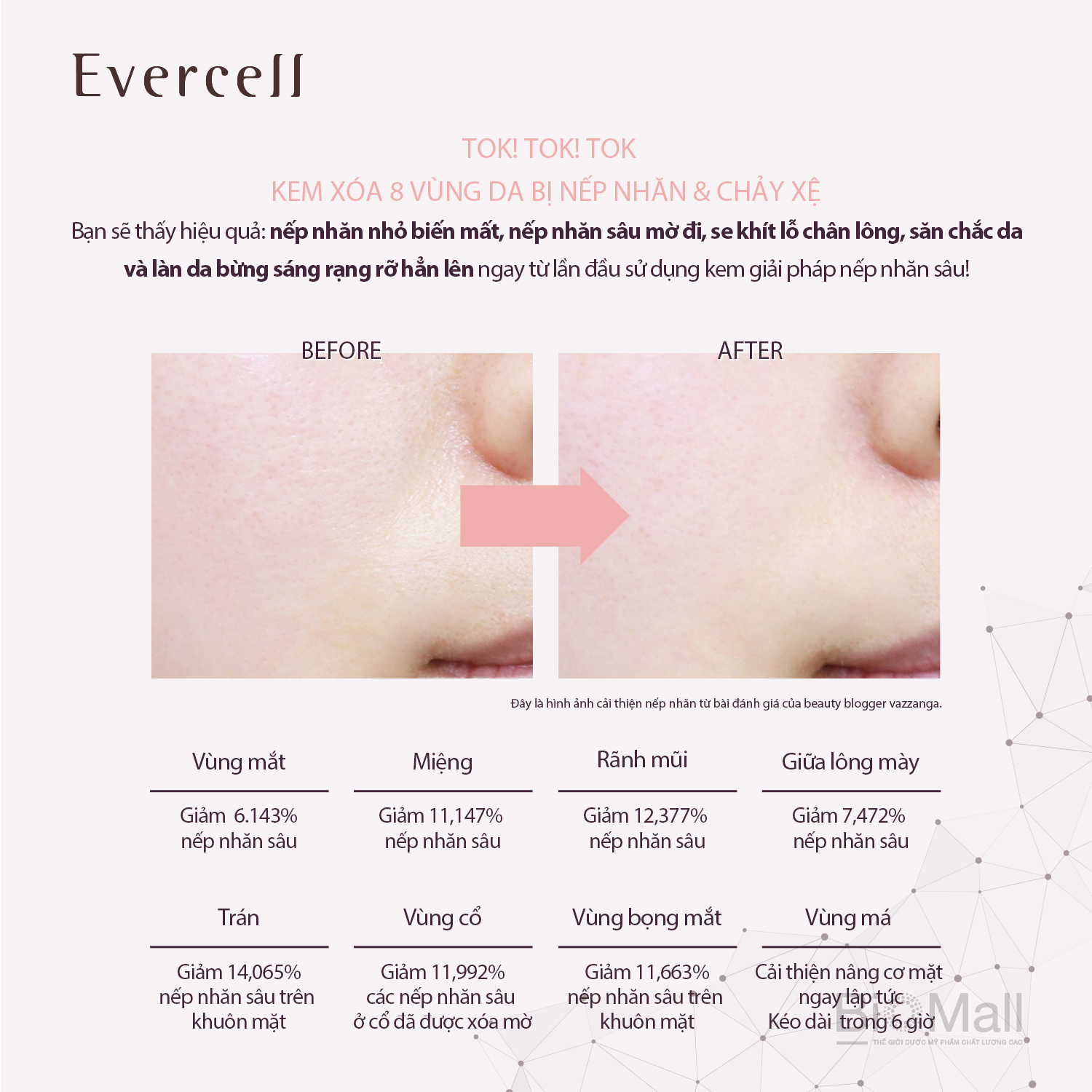 Kem chống Nếp nhăn sâu Công nghệ Tế bào gốc EVERCELL Deep Wrinkle Solution Cream nozzle type