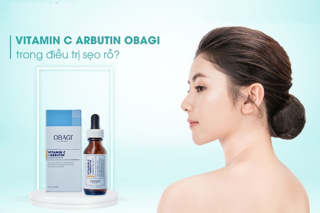 Serum dưỡng trắng da OBAGI CLINICAL Vitamin C+ Arbutin Brightening 30ml
