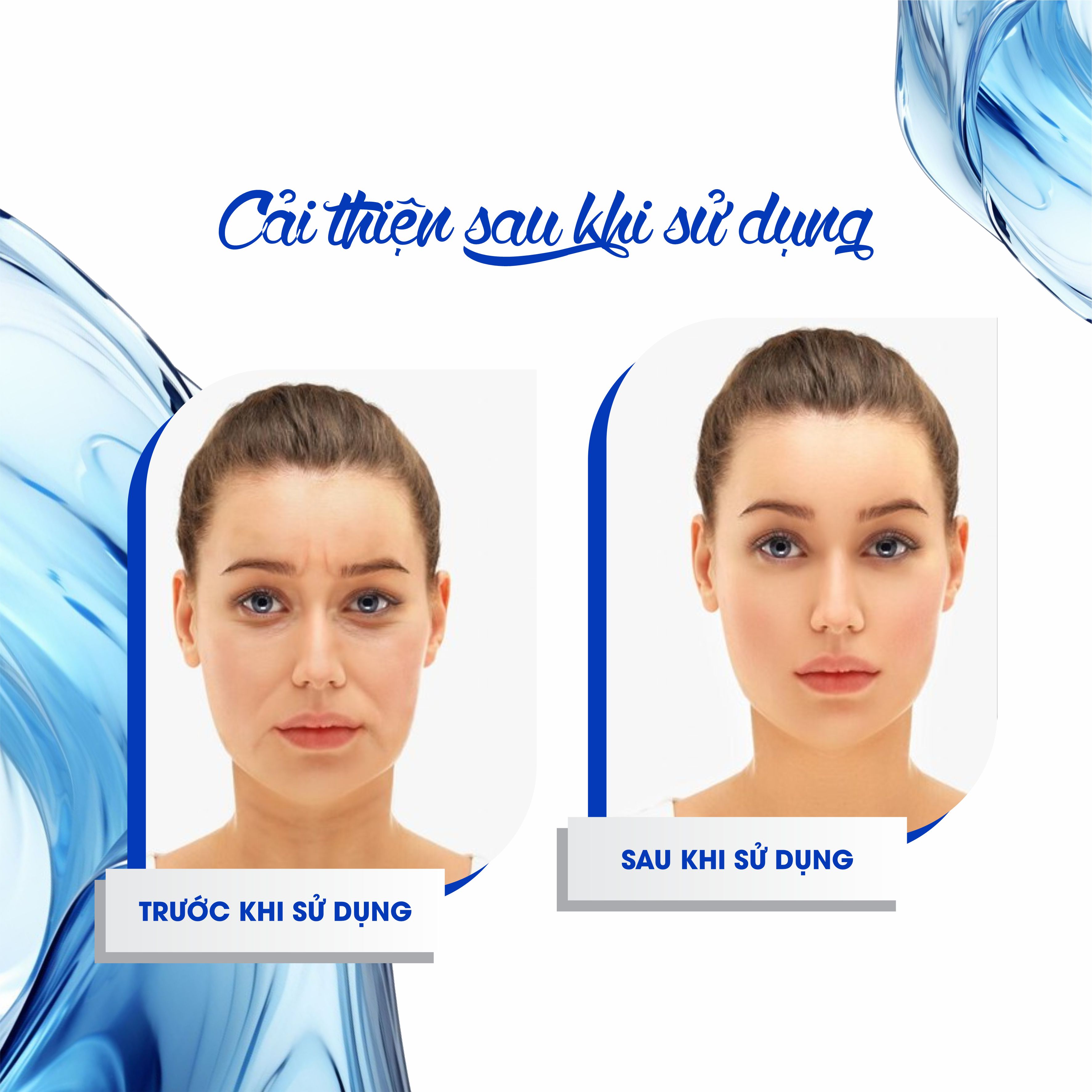 Kem Chống Nắng Phổ Rộng, Chống Bụi Mịn FCL Light Weight Non-Greasy Broad Spectrum SPF 80 Lotion 50ml