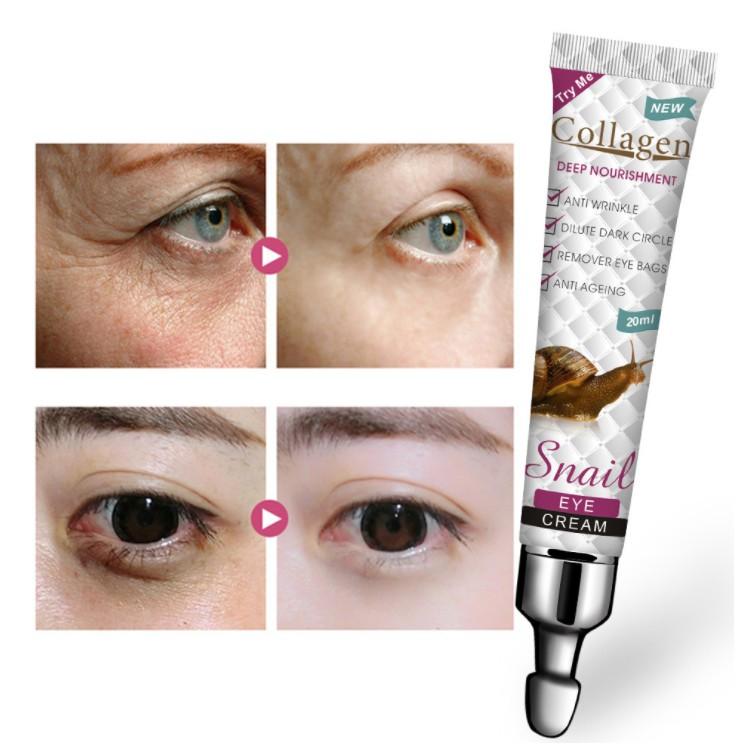 Kem dưỡng ẩm mắt Collagen Eye Cream ốc sên 20ml