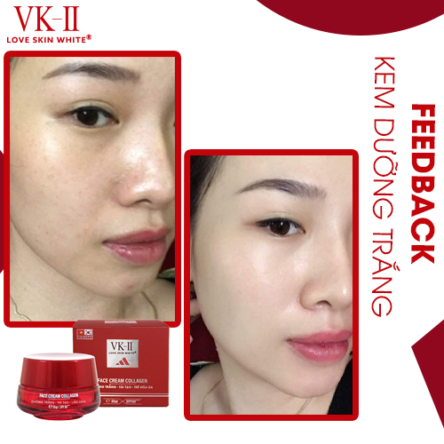 Kem Dưỡng Trắng - Tái Tạo - Trẻ Hóa Collagen VK II 35g