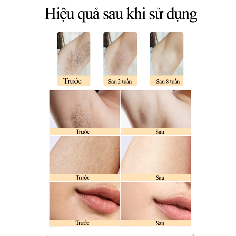 Máy Triệt Lông Mini Tẩy Lông Vĩnh Viễn Đa Năng 5 Chế Độ Trẻ Hóa Da Dùng Được Toàn Thân Máy Wax Lông Cao Cấp Vô Hạn Xung Giúp Thu Nhỏ Lỗ Chân Lông Cảm Biến Ánh Sáng Tự Động Hiệu Quả Sau 8 Tuần Sử Dụng Tặng Gel Lạnh - ML050