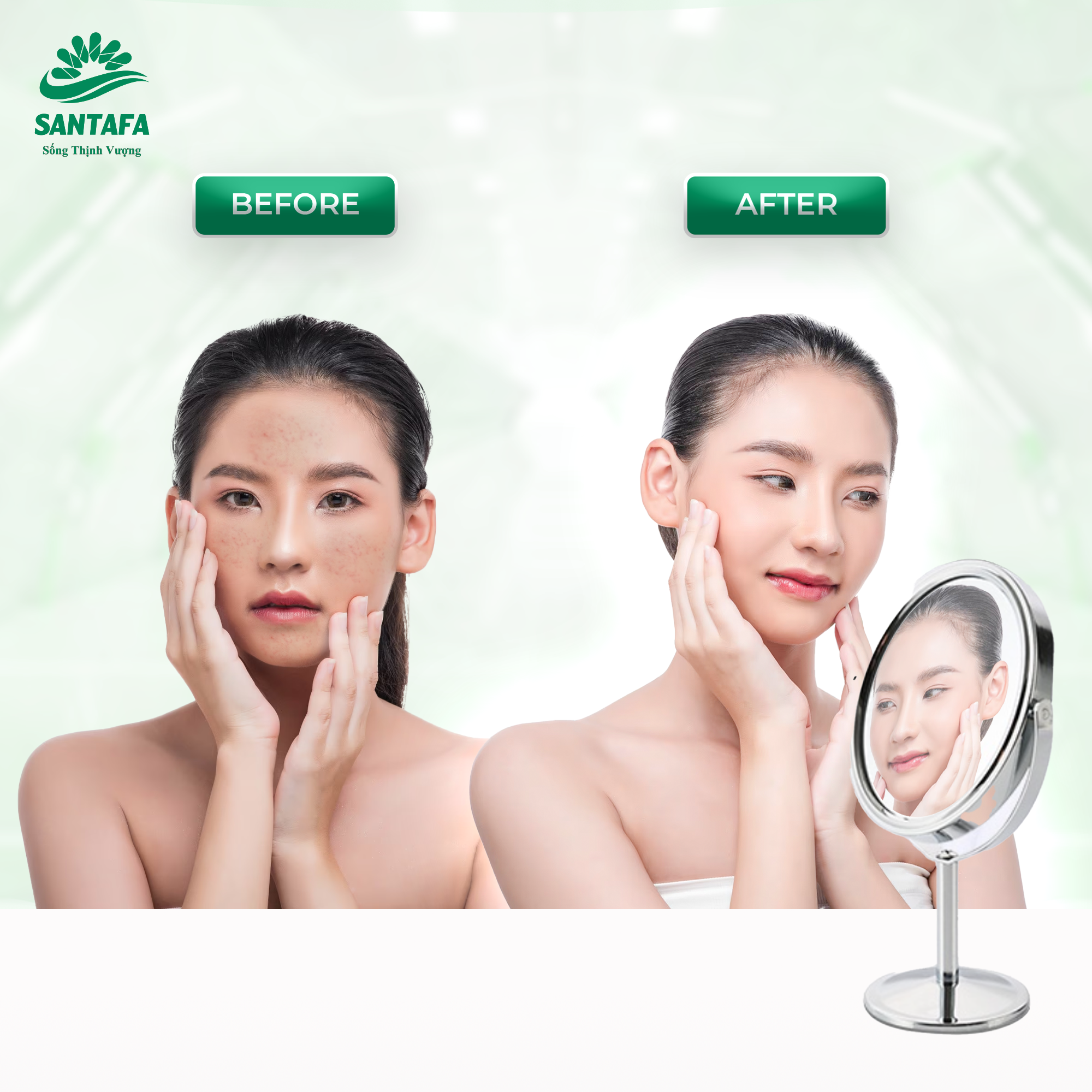 Sữa rửa mặt Acnevir Santafa - Giúp làm sạch bụi bẩn trên da,Làm giảm và ngăn ngừa mụn quay trở lại - Tuyp 50g/100g
