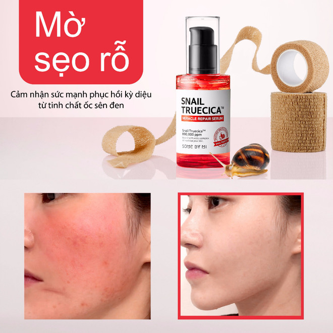 Tinh Chất Dưỡng Phục Hồi, Cải Thiện Vết Thâm, Sẹo, Làm Dịu Da Some By Mi Snail Truecica Miracle Repair Serum 50ml