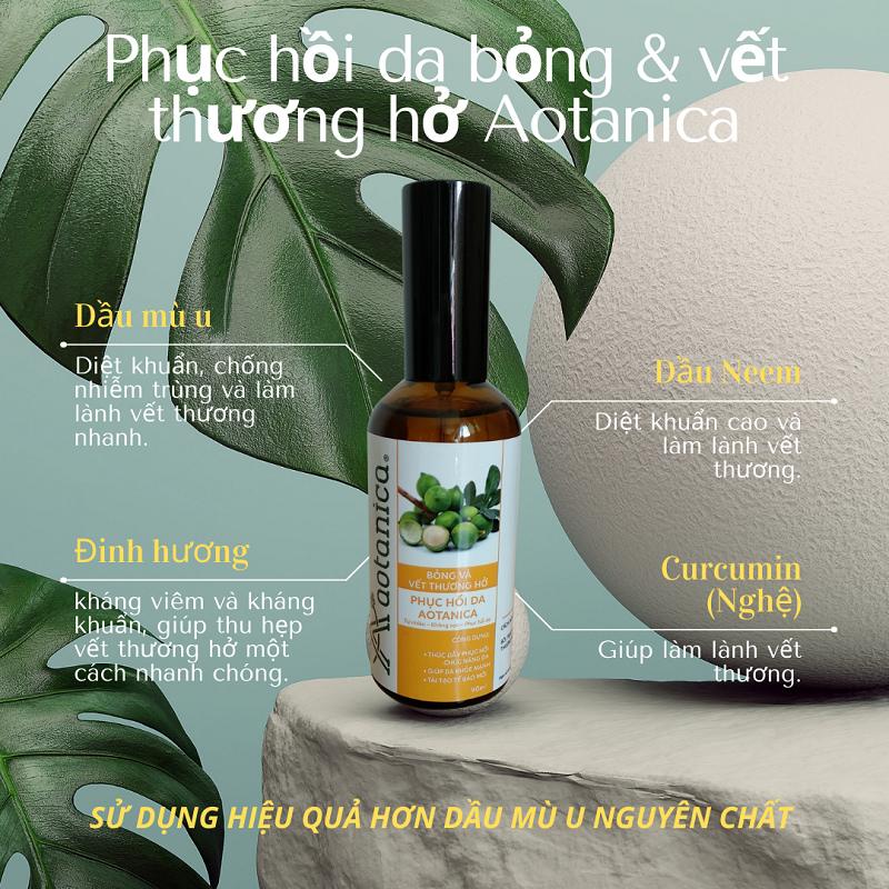 Dầu phục hồi da bỏng &amp; vết thương hở Aotanica 90ml