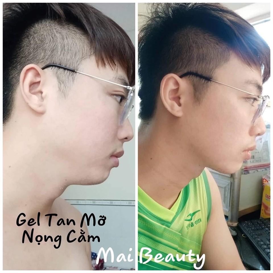 Gel Tan Mỡ Nọng Cằm Sắc Mộc Thiên - Đánh Tan Mỡ Thừa Thon Gọn Khuôn Mặt - An Toàn Hiệu Quả