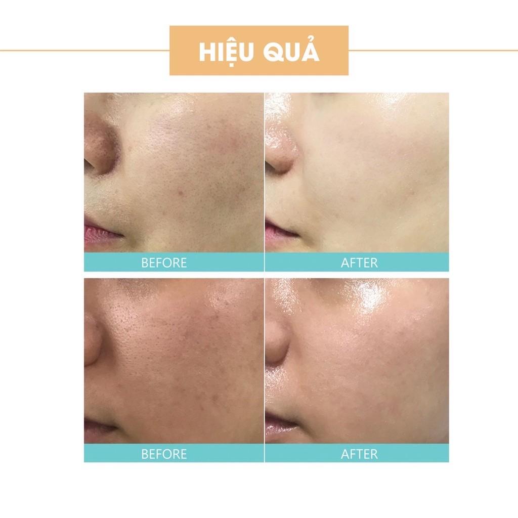 Combo 2 món: Sữa rửa mặt trà xanh + Kem face pháp