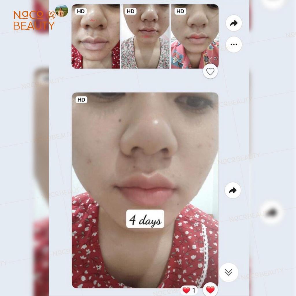 Combo Dưỡng Chuyên Sâu Mắt Môi Nacobeauty