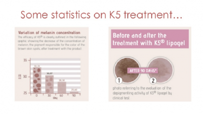 Sau 4 - 6 tuáº§n sá»­ dá»¥ng K5 Lipogel váº¿t nÃ¡m má» Äi trÃ´ng tháº¥y