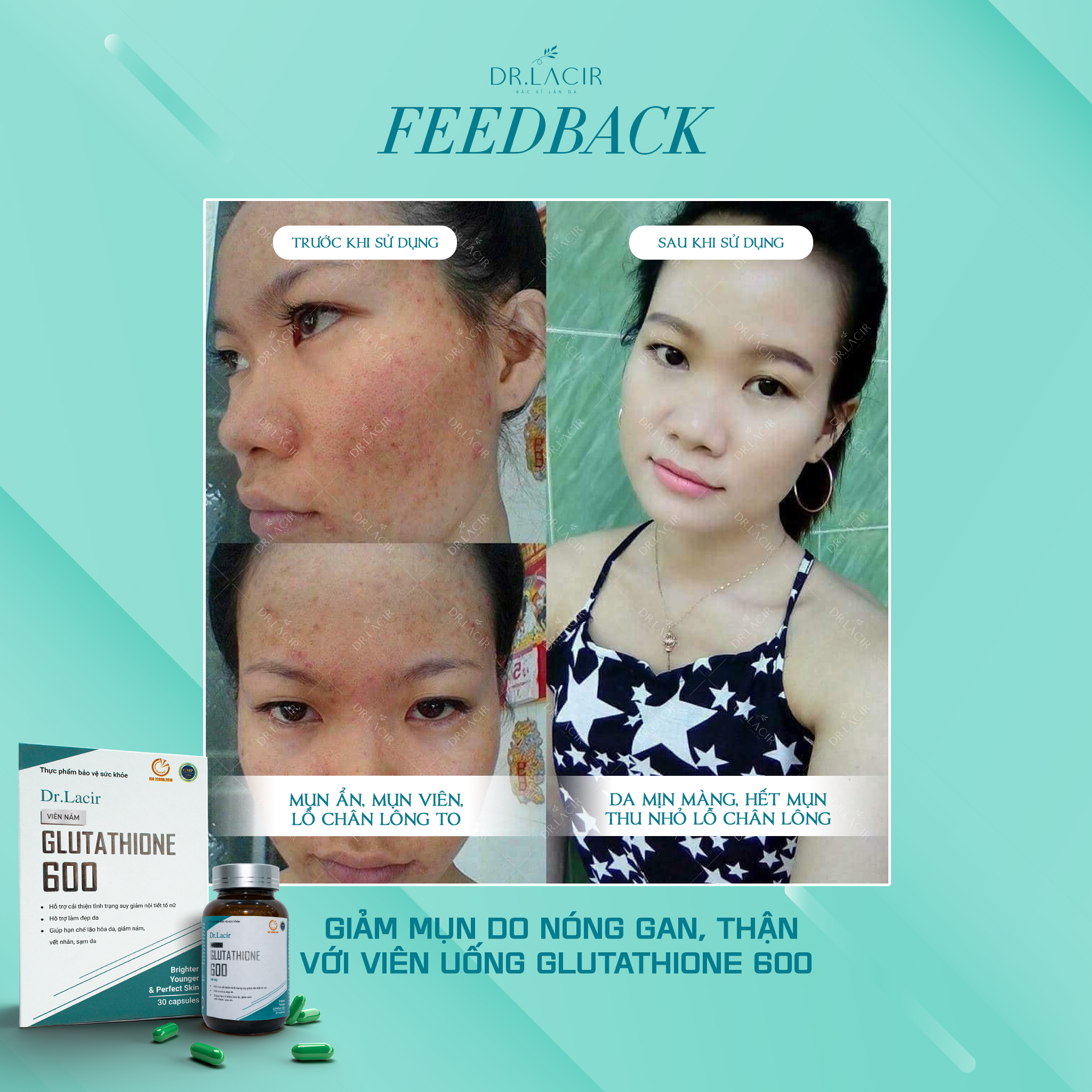 ] - Viên Uống Mờ Nám, Trắng Da Glutathione 600 - Hàng Chính Hãng Dr. Lacir