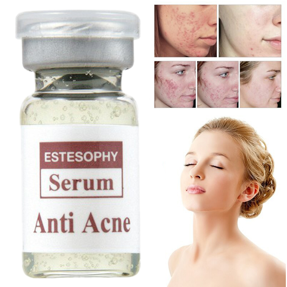 Serum đặc t rị cho da mụn es te so phy giúp tái tạo tế bào da tổn thương và chống mụn