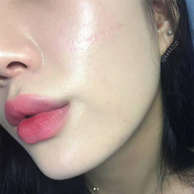 Serum Căng Bóng Da Tinh Chất Cá Hồi MULBERRY - 3 Ngày Dưỡng Trắng Mịn Màng, Thu Nhỏ Lỗ Chân Lông - Sản Phẩm Thay Thế Bortox - Tâm Sinh An Cosmetic