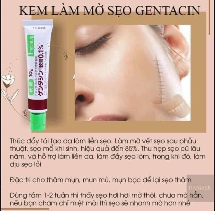 Kem Bôi Da Liền Sẹo Nhật Bản Gentacin Ngừa Mụn Thâm Và Rạn Nứt Da - Hàng Nhập Khẩu