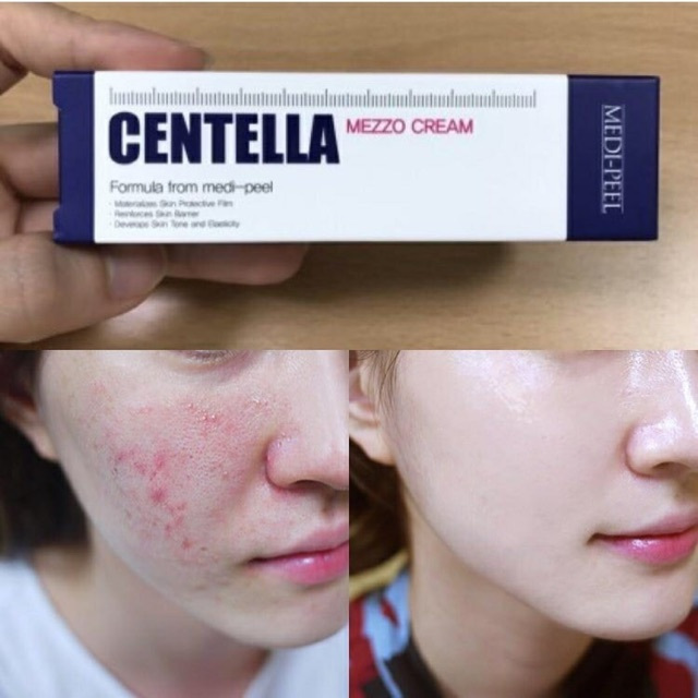  Kem Dưỡng Phục Hồi Chuyên Sâu Cho Da Mụn Medi-Peel Centella Mezzo Cream 30ml - Hàn Quốc