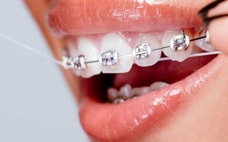 Cuộn chỉ nha khoa Lion Clinica Advantage 40m làm sạch các mảng bám giữa kẽ răng & ngăn ngừa các bệnh lý về răng miệng - Made in Japan