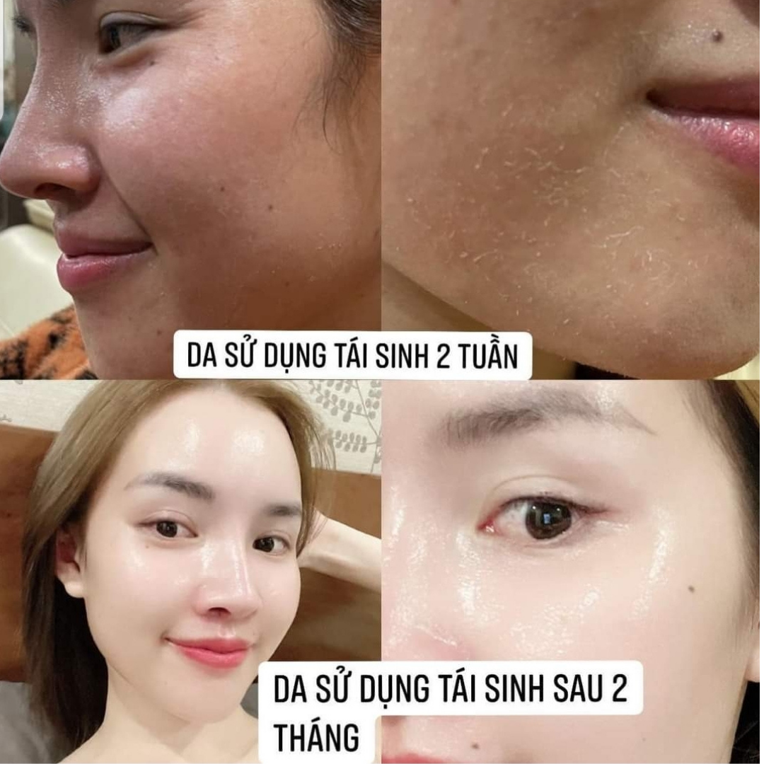 Combo Bộ Tái Sinh Retinol Complex 0.5 và Heli B5 Cream Huyền Phi Dưỡng Da Tái Tạo Chăm Sóc Làn Da Khỏe Mạnh