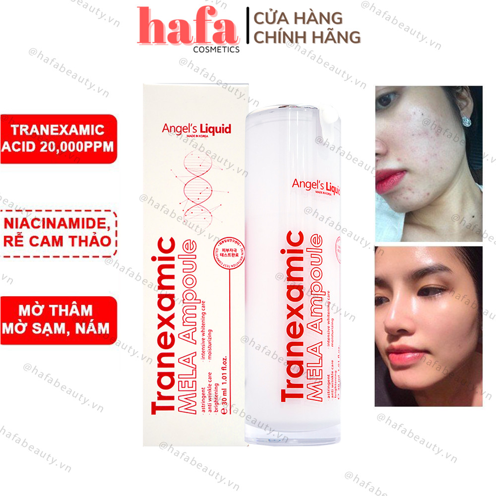 Siêu Tinh Chất Xoá Thâm Đỏ Mờ Sạm Nám Angel's Liquid Tranexamic Mela Ampoule 30ml