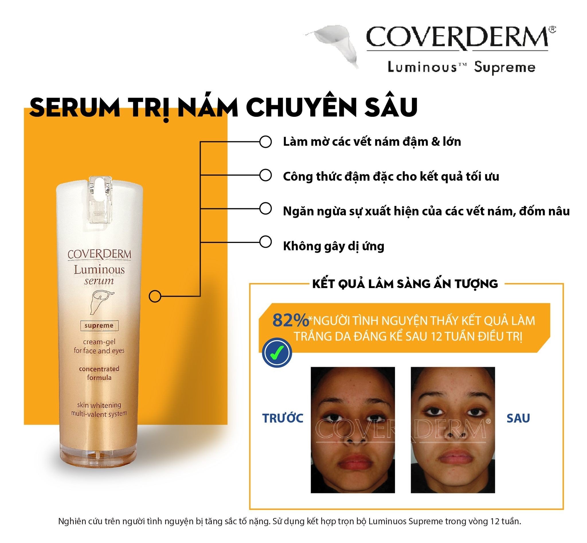 Serum Trị Nám COVERDERM Luminous Làm Trắng Da Và Phòng Ngừa Thâm Sạm Dung Tích 20ml