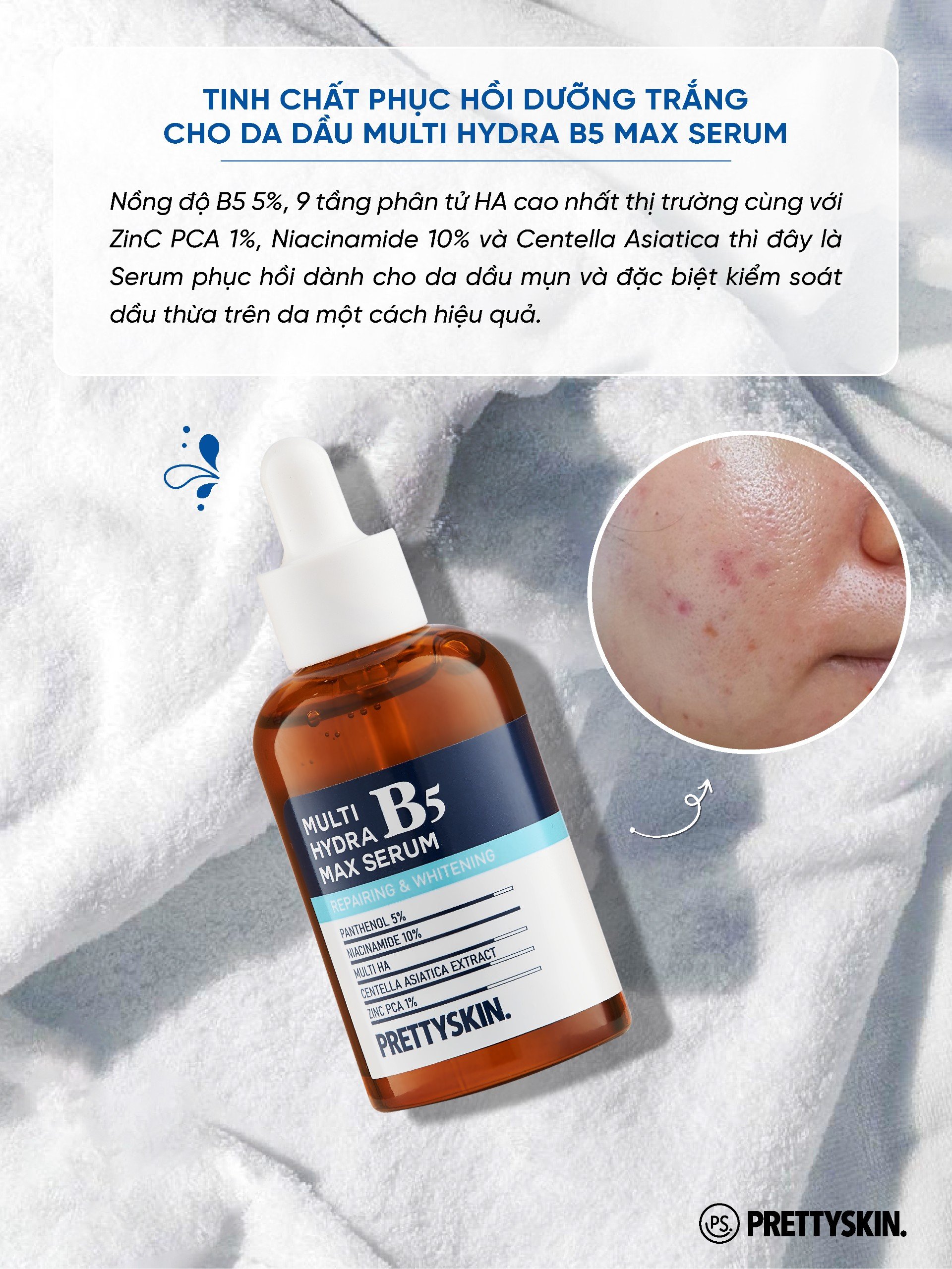 Serum B5 Multi Hydra Max Prettyskin giúp phục hồi dưỡng trắng dành cho da dầu mụn, da khô 50ml