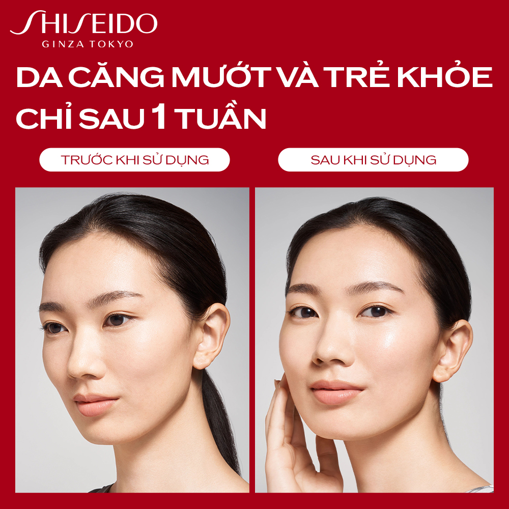 Nước thần đỏ Shiseido Eudermine Activating Essence 145ml